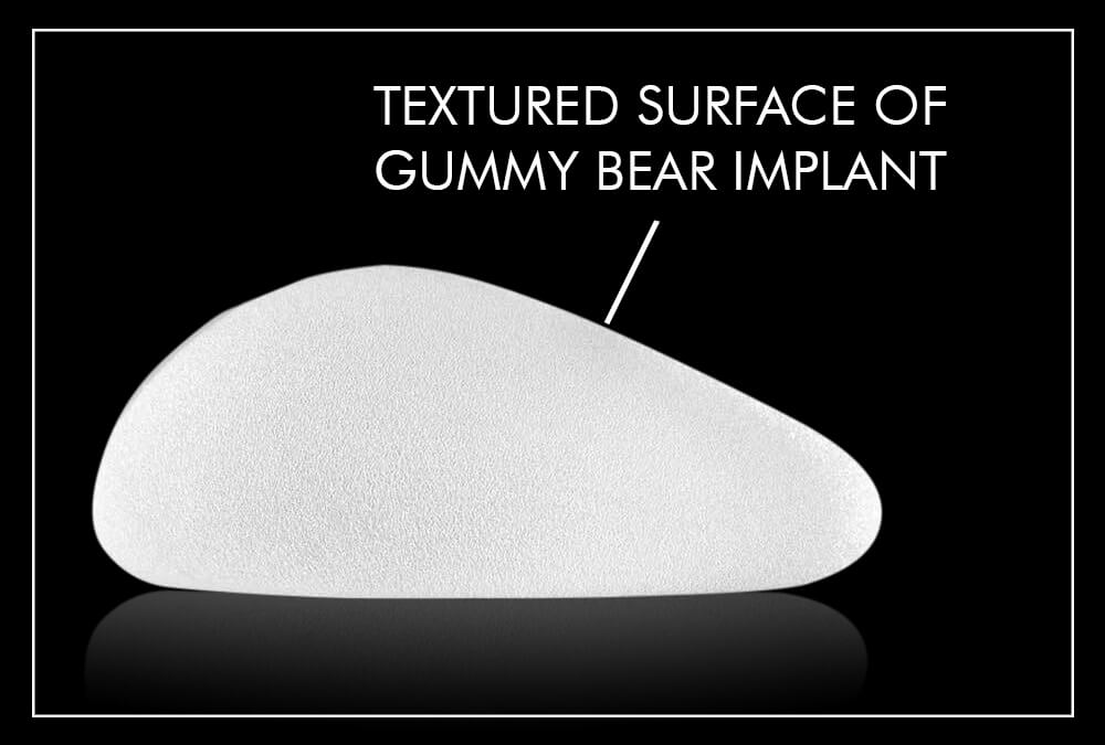 img-6-gummy-bear